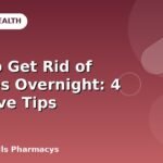 How to Get Rid of Pimples Overnight: 4 Effective Tips