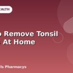 How To Remove Tonsil Stones At Home