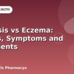 Psoriasis vs Eczema: Causes, Symptoms and Treatments